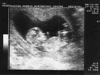 birth02.jpg (56998 bytes)