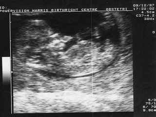 birth03.jpg (61110 bytes)