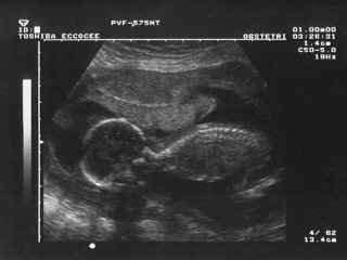 birth04.jpg (46768 bytes)